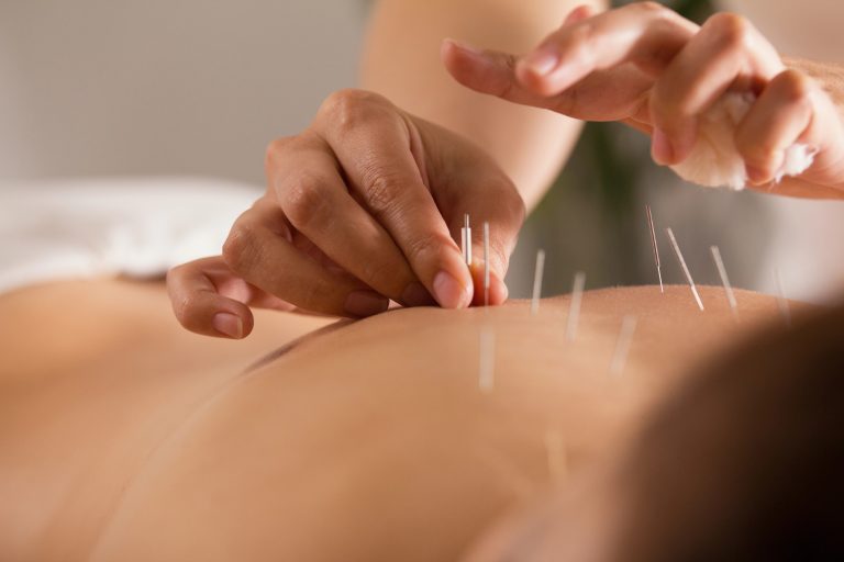 comissao-debate-criacao-do-dia-da-acupuntura-e-da-medicina-tradicional-chinesa
